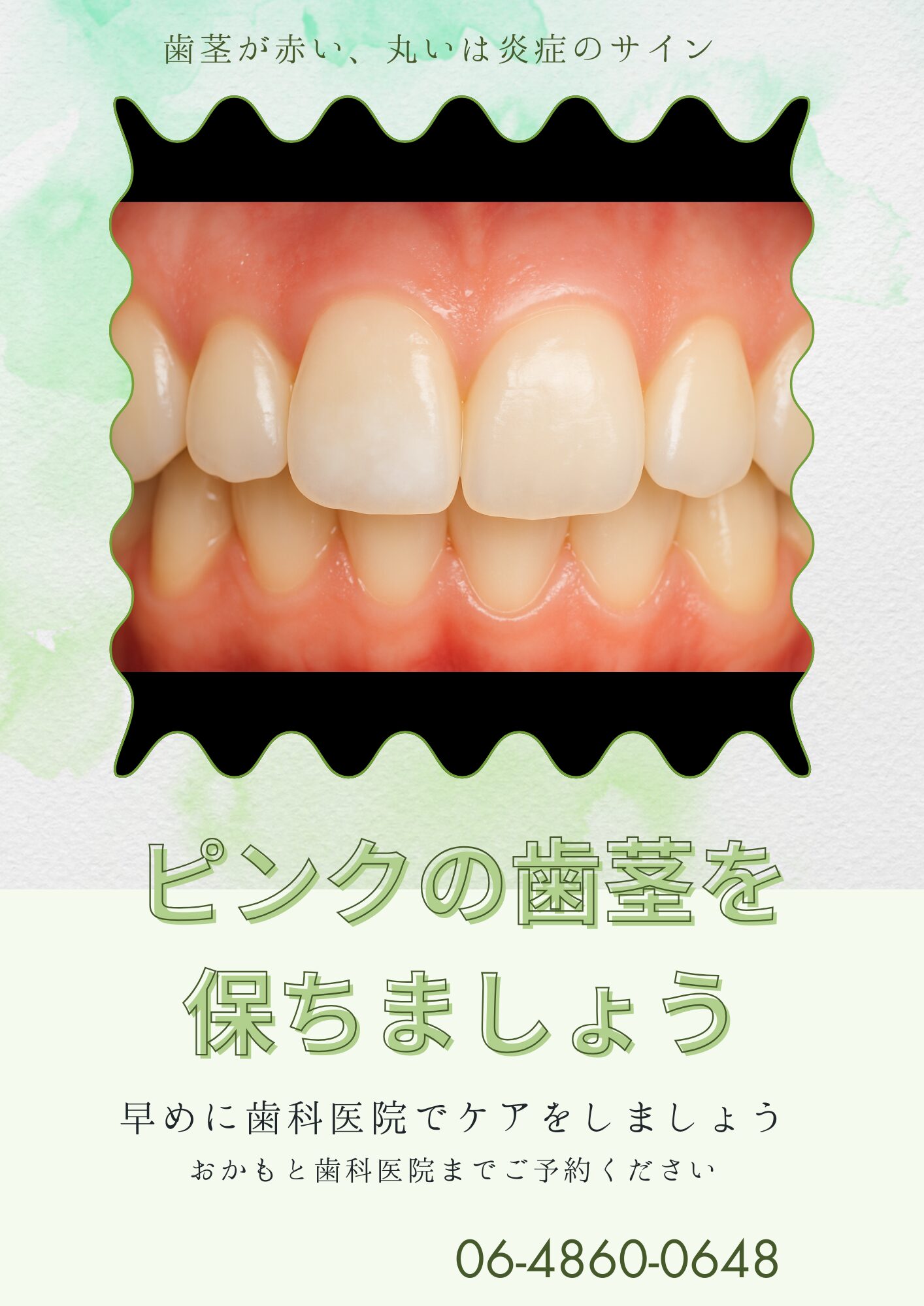 健康 な 歯茎