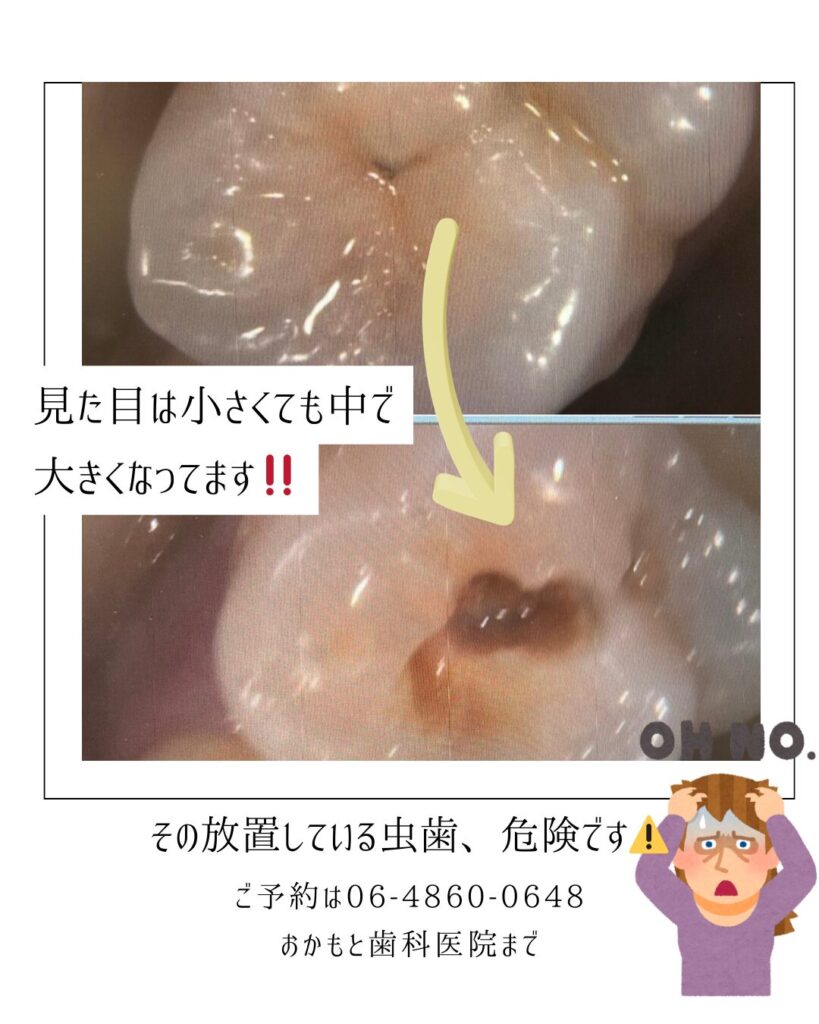 定期検診の大切さ