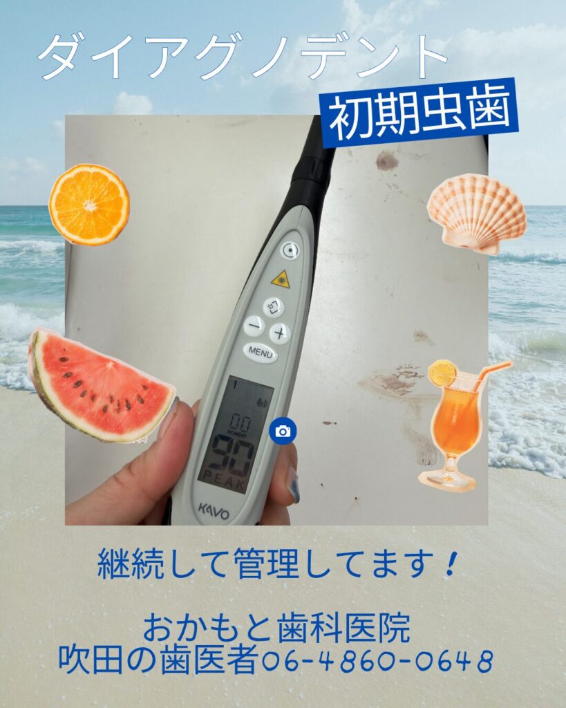 虫歯は早めに